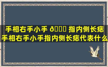 手相右手小手 🐎 指内侧长痣（手相右手小手指内侧长痣代表什么）